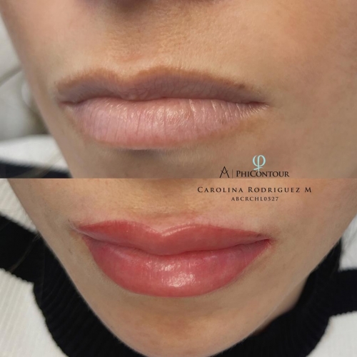 Acuarela Lips