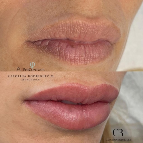 Acuarela Lips
