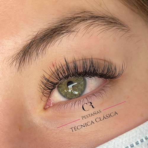 Extensiones T&eacute;cnica Cl&aacute;sica