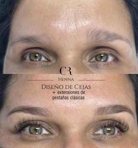 Extensiones Técnica Clásica